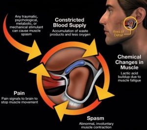 TMJ TREATMENT